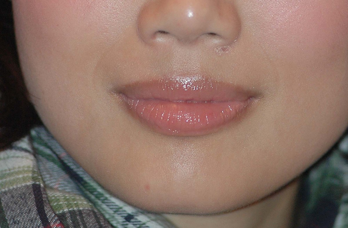 嘴片发黑发紫是什么情况