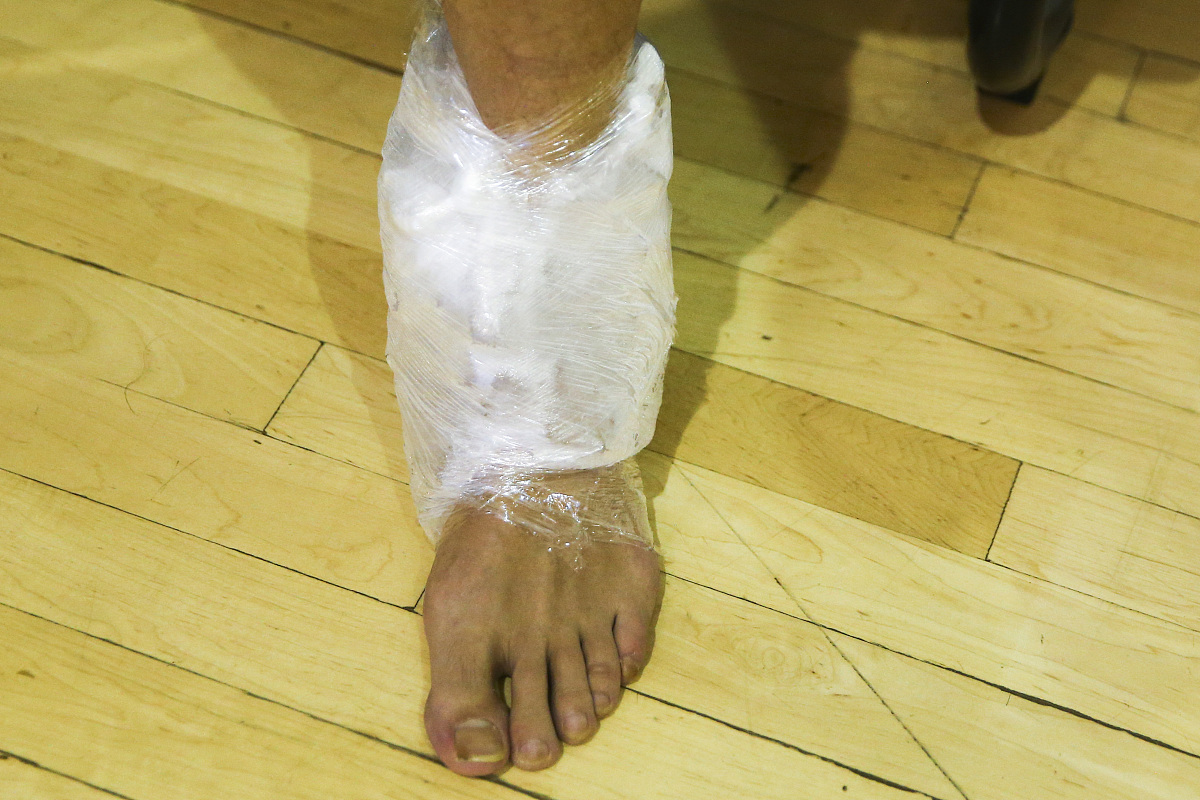 脚踝二级扭伤康复计划：急性期、增殖期、重塑期详细指南