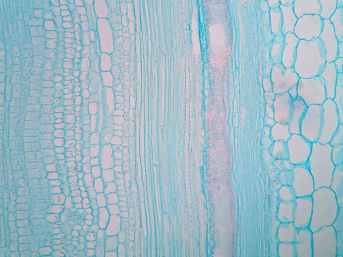 润色下这句话并修改下语句顺序木本植物杨树EST库中筛选出PttMYB3Ra 、PttMYB4a 和 PttMYB21a3参与次生维管组织形成的MYB家族成员其中PttMYB21a是CCoAoMT的转录抑制因子在次生细胞壁形成区表达量较高。