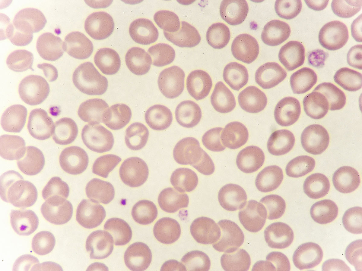 亚甲基蓝染色红细胞颜色：显微镜下观察