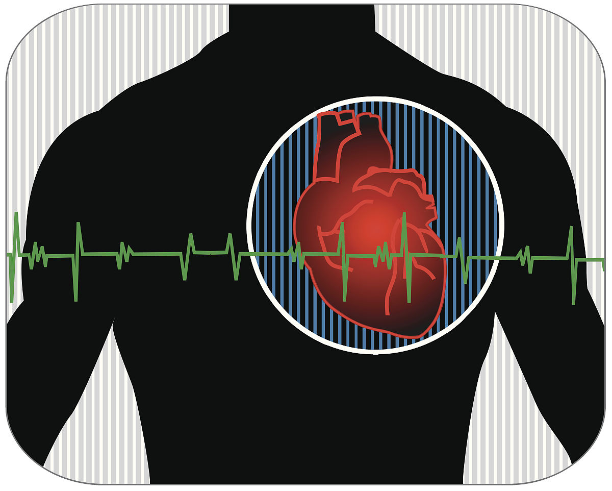 为什么能在体表测量到心电图？我们一般看到的体表心电图是心电信号的几次投影？心电图12导联的获得原理？什么是威尔逊网络？其中心点电位是否为0？为什么？心率和脉搏是同一概念吗？