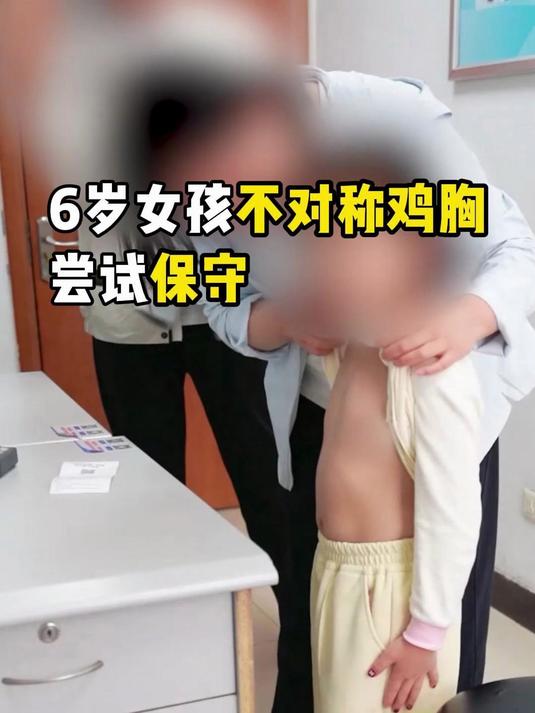 6岁女孩不对称鸡胸，尝试保守