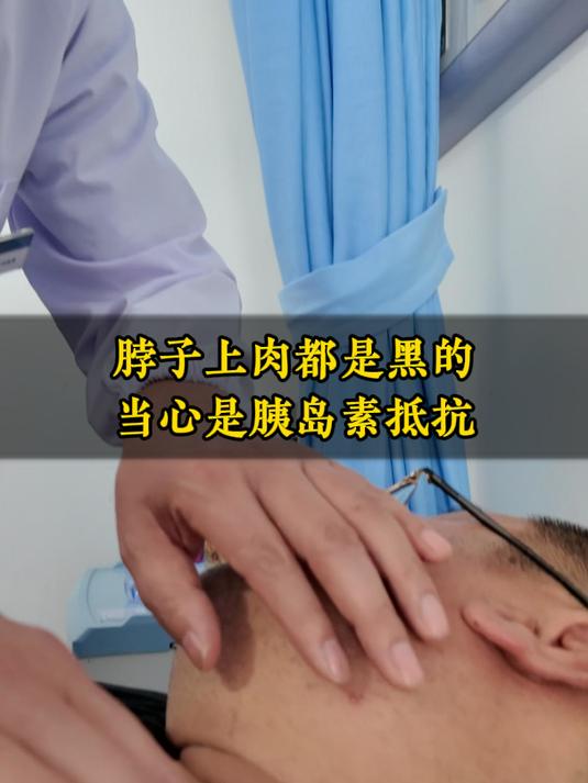 脖子上的肉都是黑的,这就是胰岛素抵抗导致的黑棘皮