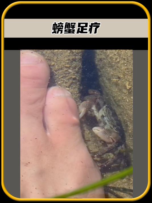 鱼疗相信大家都不陌生,但你有没有见过螃蟹足疗,太有趣了