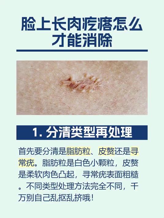 脸上长肉疙瘩怎么才能消除