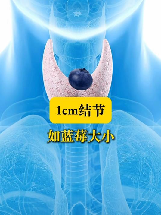 甲状腺结节大小实物参照图