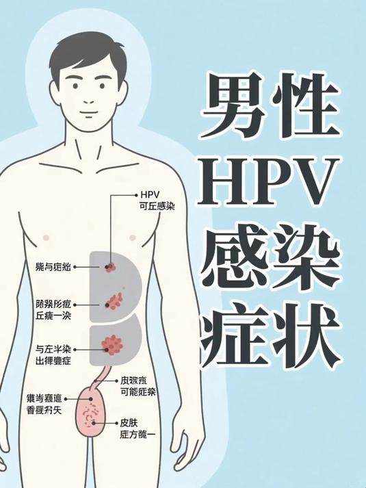 男性hpv感染症状
