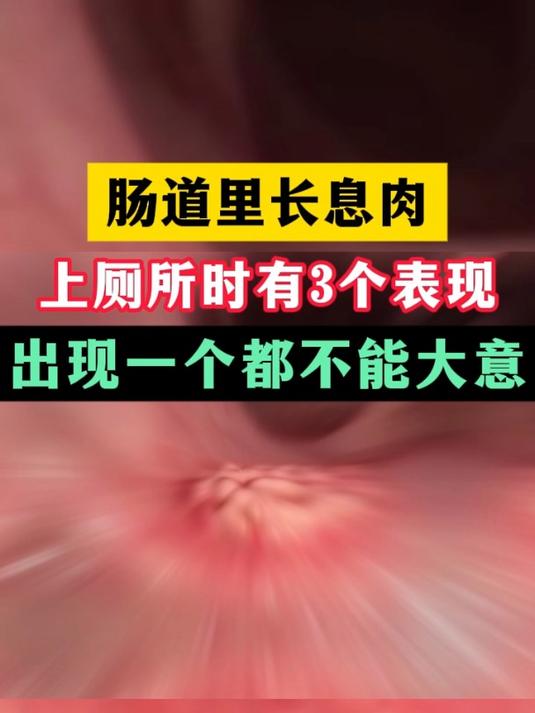 肠道里长息肉 上厕所时有3个表现 出现一个都不能大意