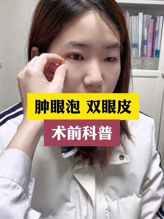 肿眼泡埋线双眼皮 术前科普 肖潮医生真实案例讲解