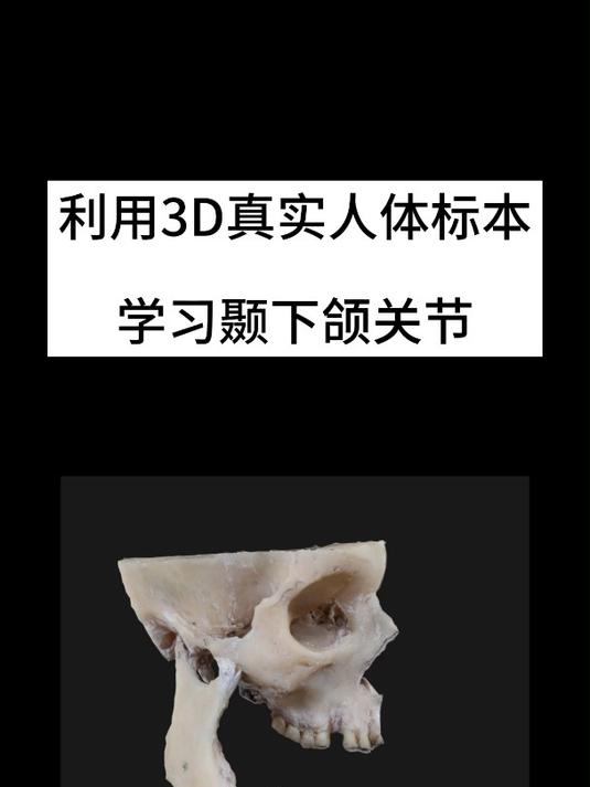 利用维萨里3D解剖学习颞下颌关节