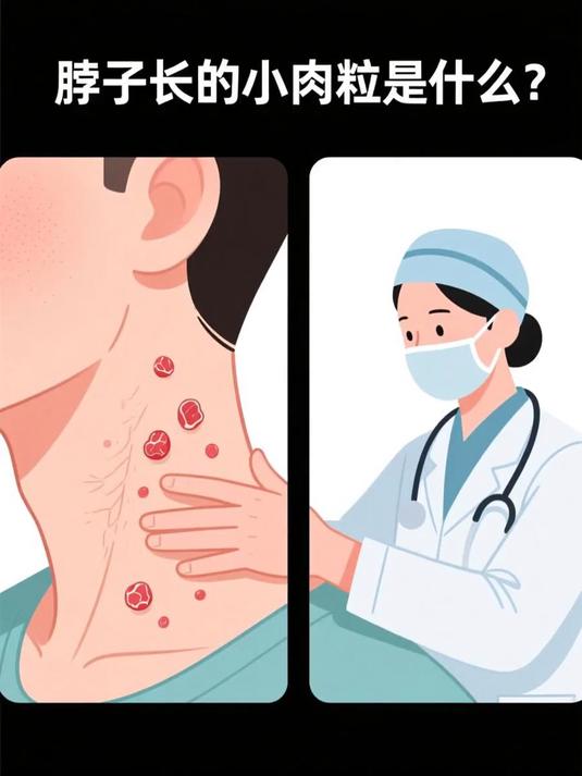 脖子长的小肉粒是什么 #健康扬帆季#