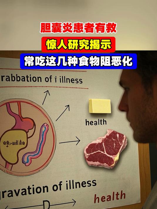 胆囊炎患者有救,惊人研究揭示,常吃这几种食物阻恶化