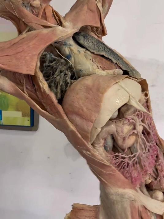 大体老师非常伟大,内脏的分布非常清晰