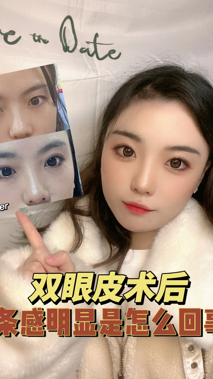 双眼皮术后肉条感明显,需要做手术修复吗?