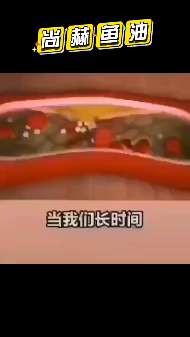 尚赫鱼油血管清道夫 清理血管垃圾 提高记忆力