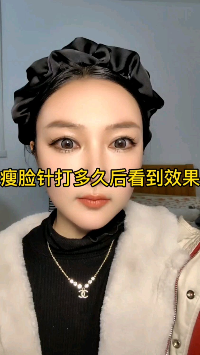 瘦脸针打完后多久看到效果