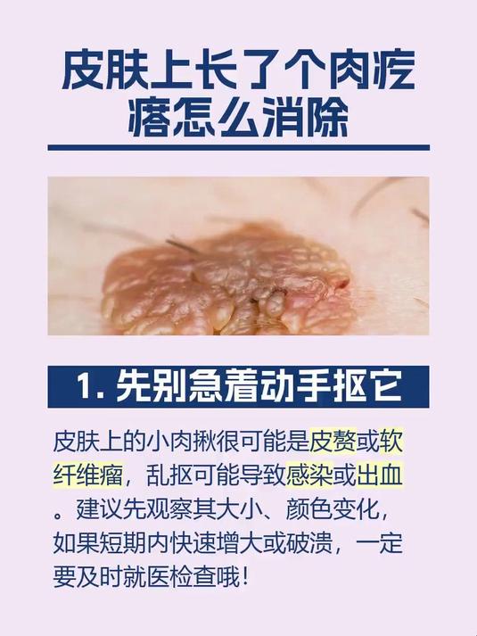 皮肤上长了个肉疙瘩怎么消除