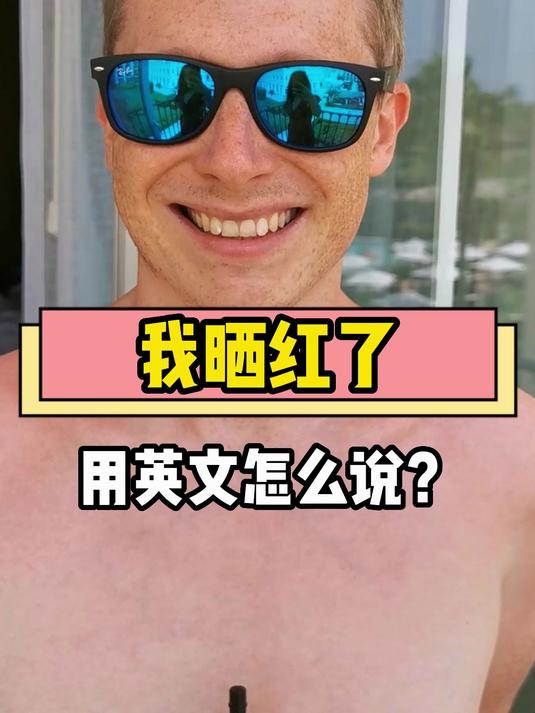 我晒红了用英文怎么说?