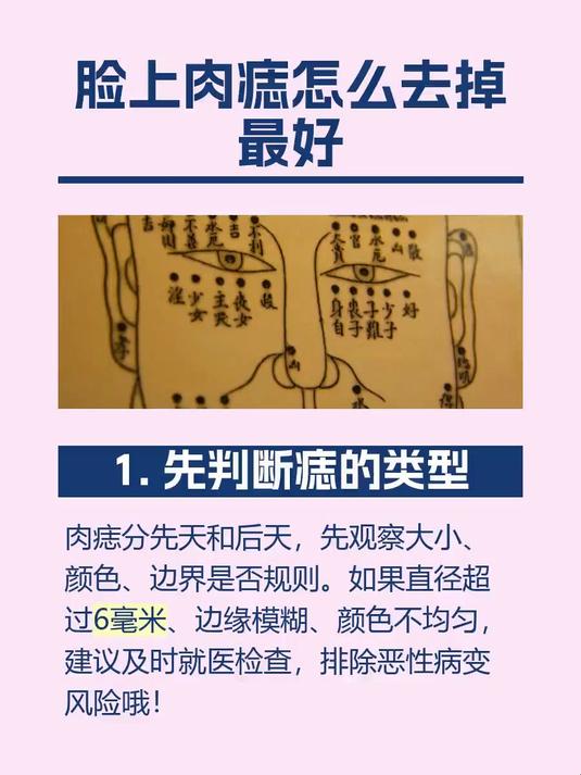 脸上肉痣怎么去掉最好