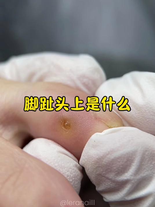 脚趾头上是什么呢