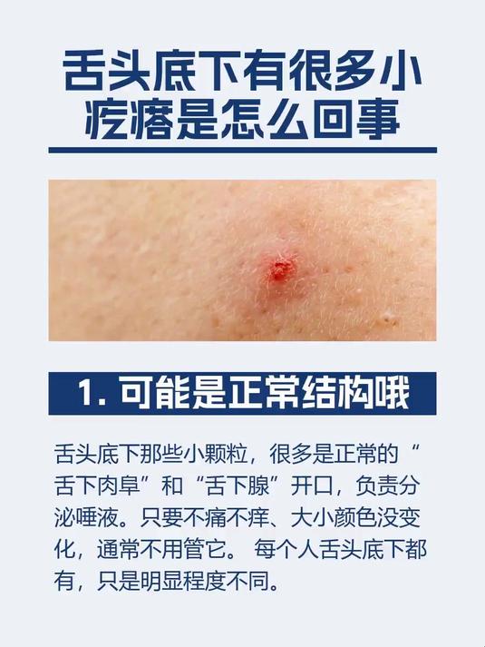 舌头底下有很多小疙瘩是怎么回事
