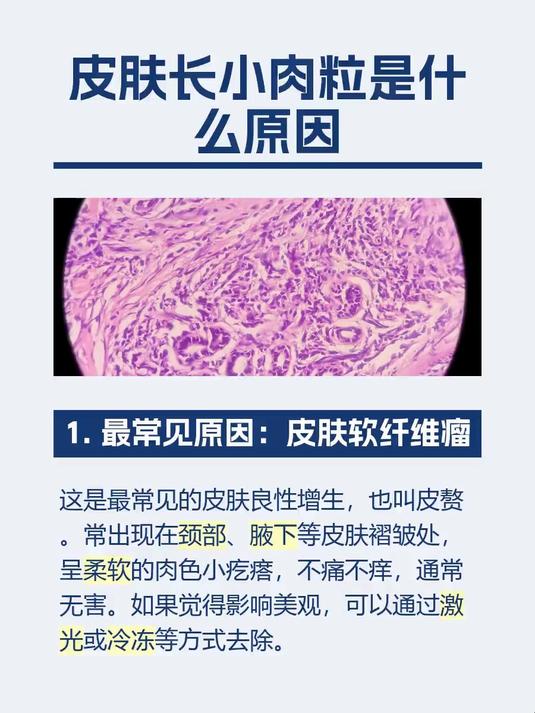 #马上健康过大年#皮肤长小肉粒是什么原因
