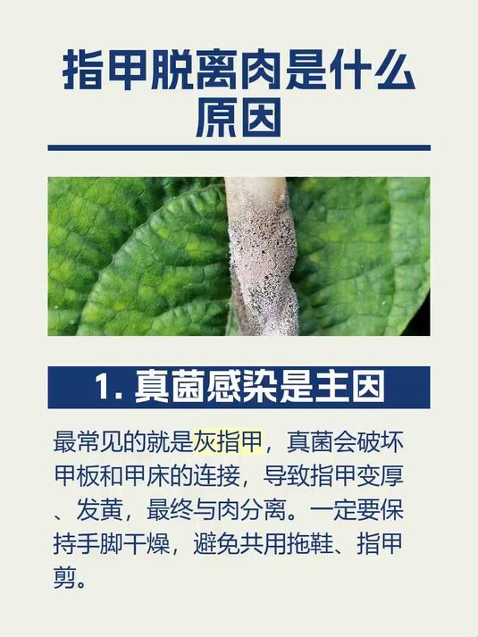 #马上健康过大年#指甲脱离肉是什么原因