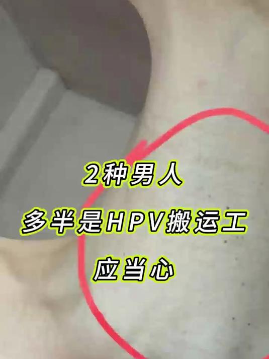 2种男人,多半是HPV搬运工,应当心