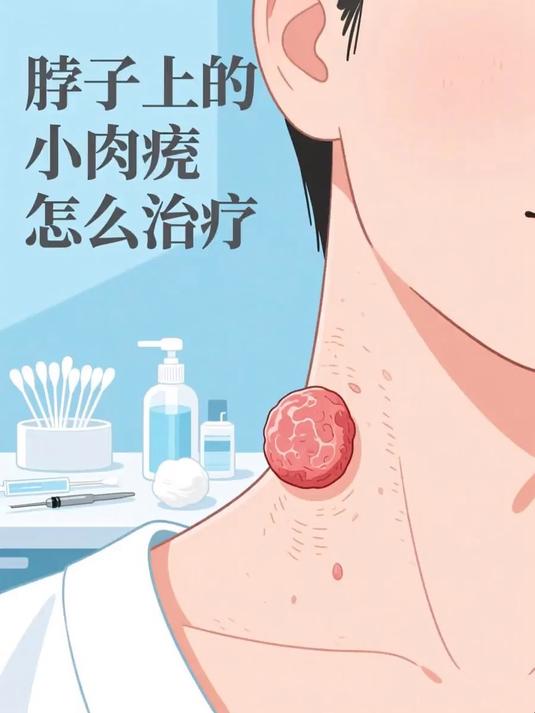 #马上健康过大年#脖子上的小肉疣怎么治疗