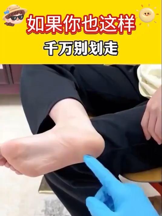活络油擦涂不黏腻,运动后解肌肉累,放松身体超舒服!