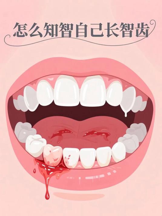 怎么知道自己长智齿 #健康扬帆季#