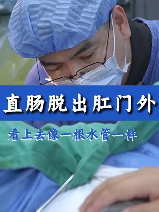 直肠脱出肛门外像一根水管一样
