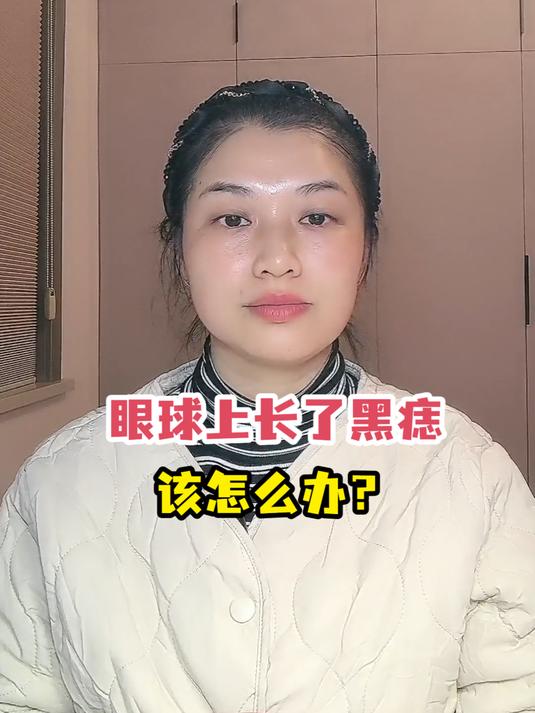眼球上长了黑痣该怎么办?