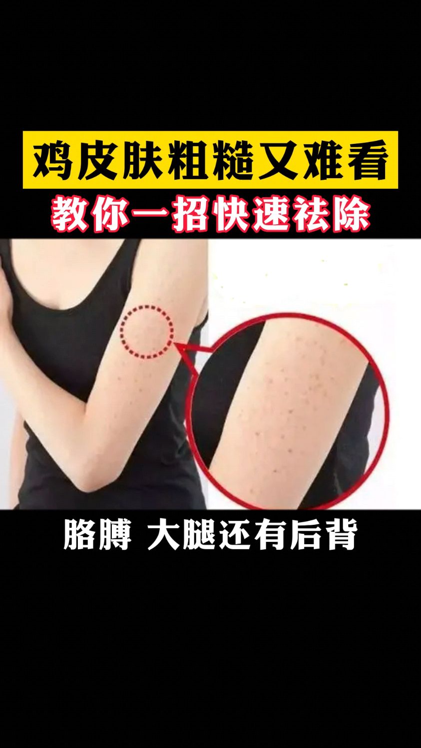 鸡皮肤粗糙又难看教你一招快速祛除