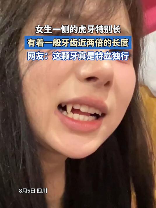 女生一侧的虎牙特别长,有着一般牙齿近两倍的长度