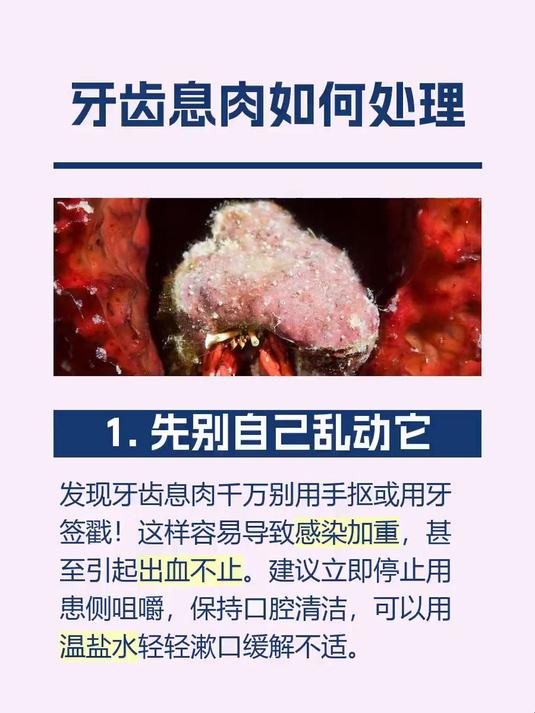 牙齿息肉如何处理