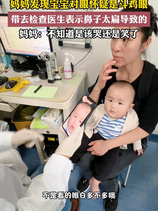 妈妈发现宝宝对眼怀疑是斗鸡眼,带去检查医生表示鼻子太扁导致的