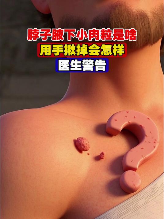 脖子腋下“小肉粒”是啥，用手揪掉会怎样，医生警告，看完必知！
