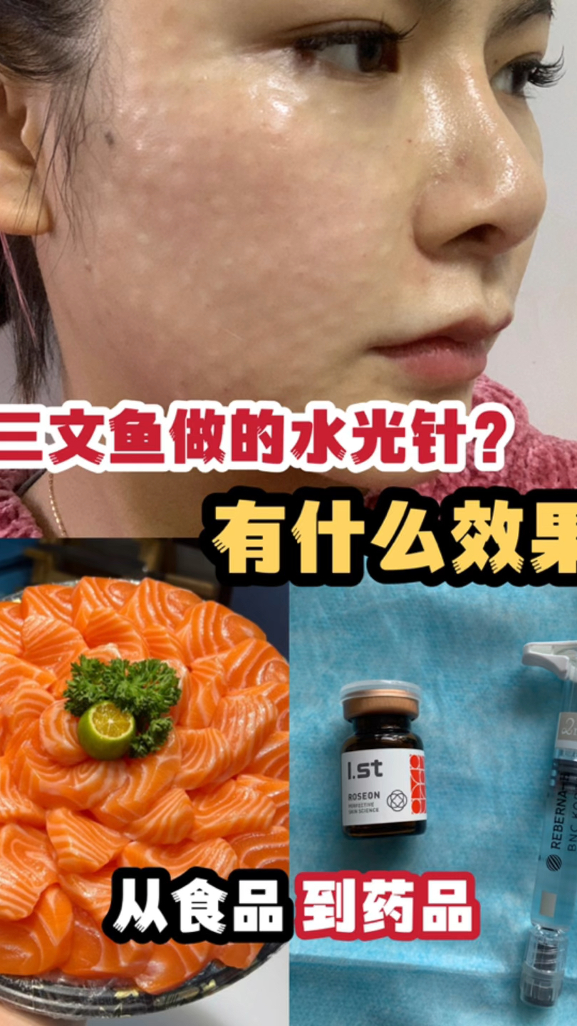 三文鱼从食品到药品,水光针三文鱼是什么意思?