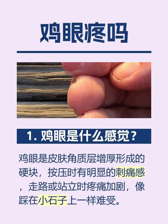 鸡眼疼吗