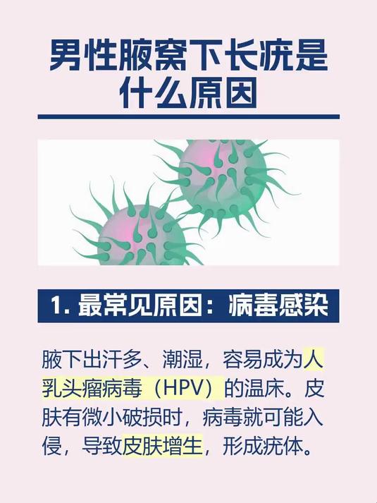男性腋窝下长疣是什么原因