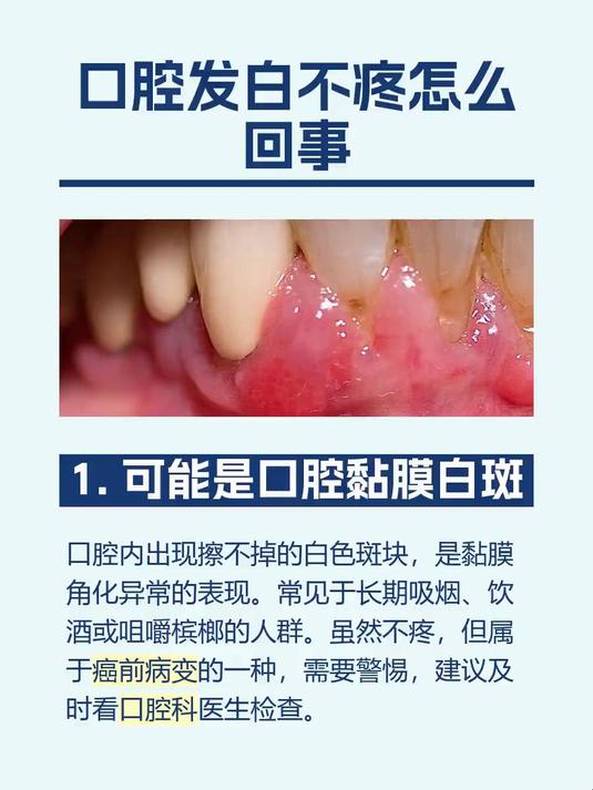 #马上健康过大年#口腔发白不疼怎么回事