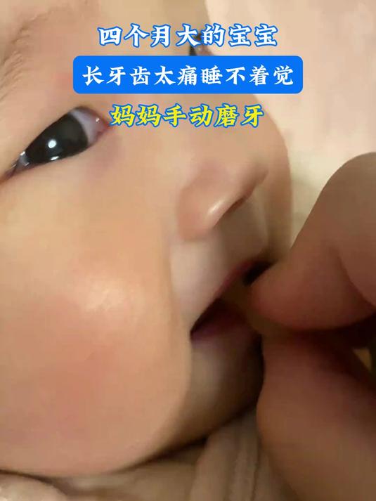 四个月大的宝宝,长牙齿太痛睡不着觉,妈妈手动磨牙