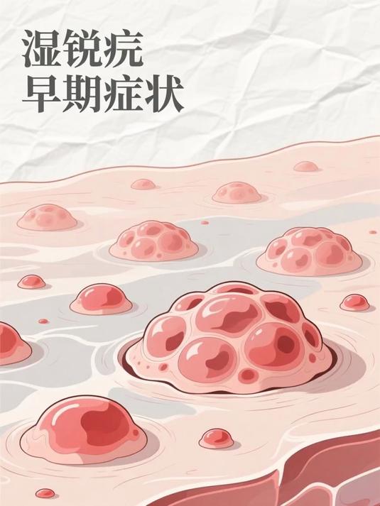 湿锐疣早期症状