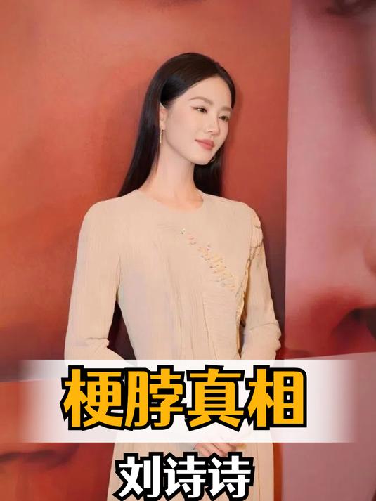 为何刘诗诗总梗着脖子?当背后真相曝光,果然不是天鹅颈那么简单