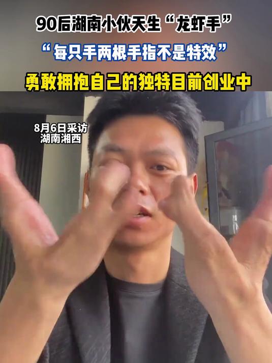 90后湖南小伙天生“龙虾手”，“每只手两根手指不是特效”