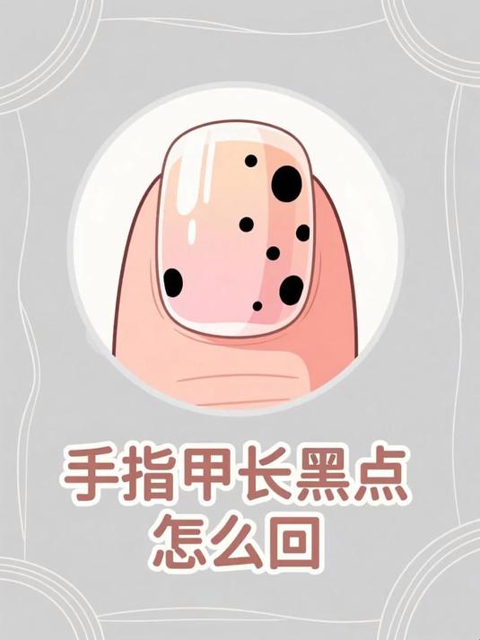 手指甲长黑点怎么回事