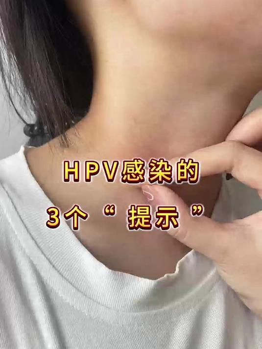 HPV感染的3个“提示”