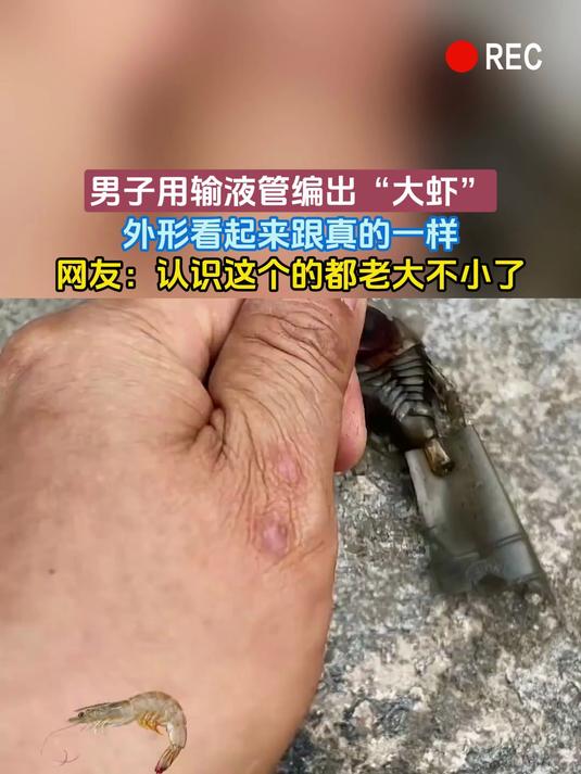 男子用输液管编出“大虾”，外形看起来跟真的一样，网友：认识这个的都老大不小了