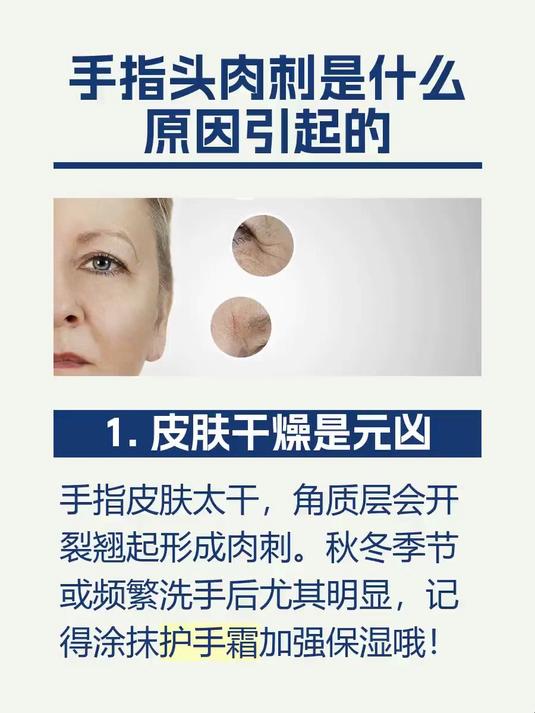 手指头肉刺是什么原因引起的